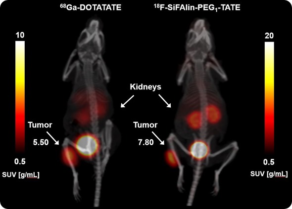 Comparison SUV intensity: 0-90min_1mm Gauss