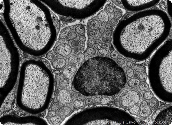 TEM schwann cell