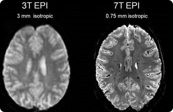 Increasing access to MRI scanning