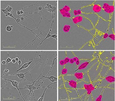 Five neuronal model systems imaged in an IncuCyte ZOOM in phase