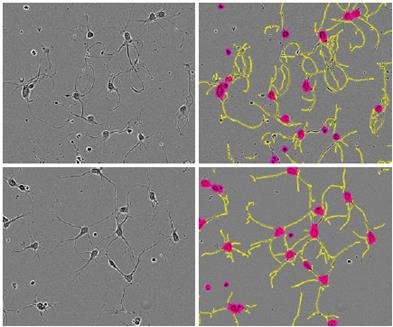 Phase images of E18 rat cortical cells