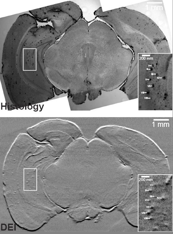 Images of the brain of a transgenic mouse obtained through histology and the corresponding brain region imaged with DEI in computed tomography mode. Images of the brain of a transgenic mouse obtained through histology and the corresponding brain region imaged with DEI in computed tomography mode.