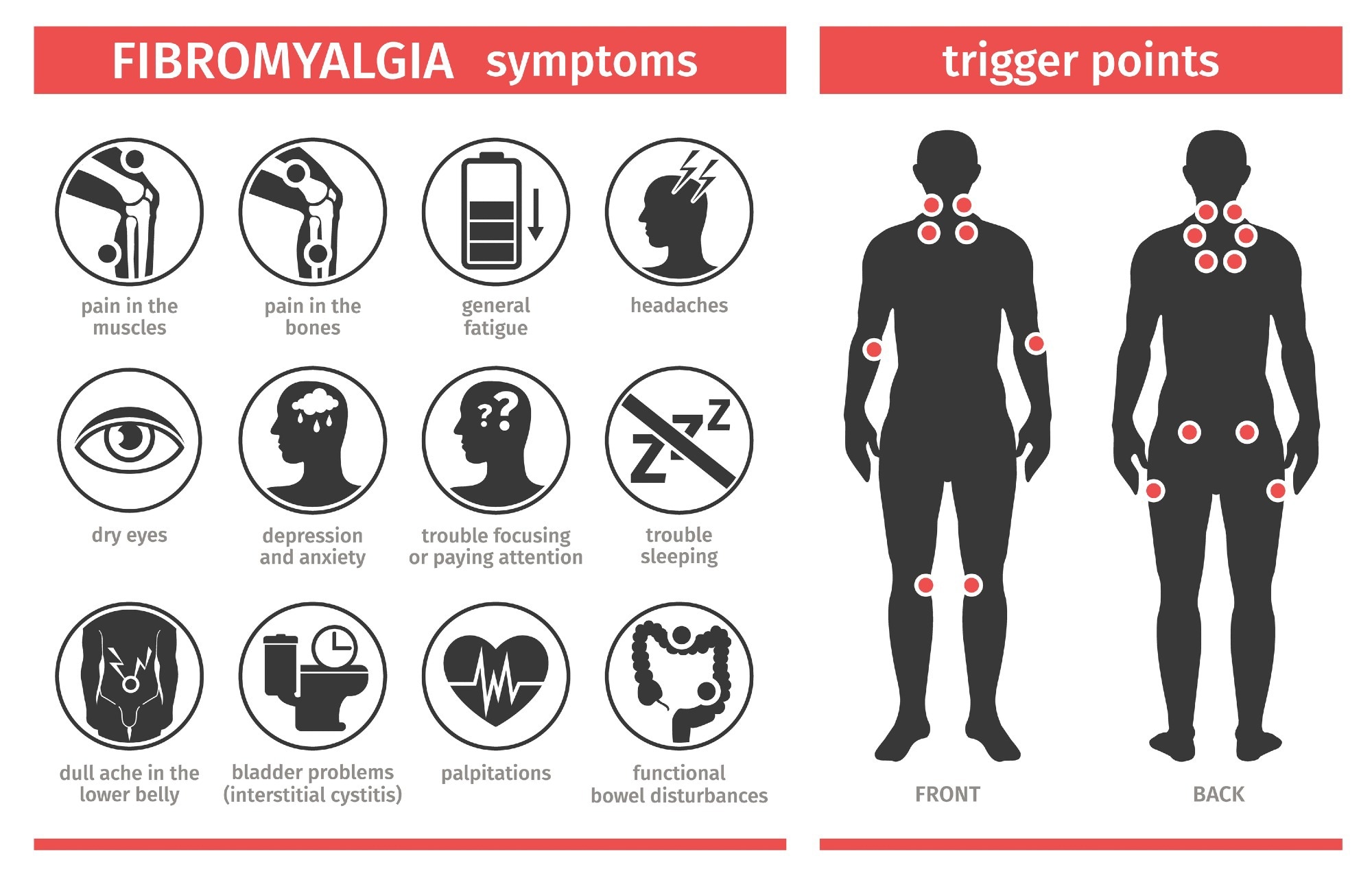 : A visual infographic about fibromyalgia. On the left, under the heading “Fibromyalgia Symptoms,” there are icons and text listing common symptoms: pain in the muscles, pain in the bones, general fatigue, headaches, dry eyes, depression and anxiety, trouble focusing or paying attention, trouble sleeping, dull ache in the lower belly, bladder problems (interstitial cystitis), palpitations, and functional bowel disturbances. On the right, under the heading “Trigger Points,” a front and back silhouette of a human body highlight common trigger points with red dots on areas like the neck, shoulders, elbows, lower back, hips, and knees.
