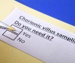 What is Chorionic Villus Sampling?