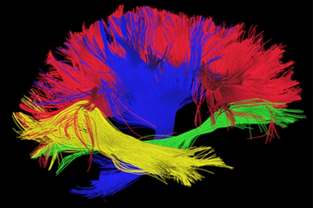 Image Credit: Image Source Trading Ltd/Shutterstock