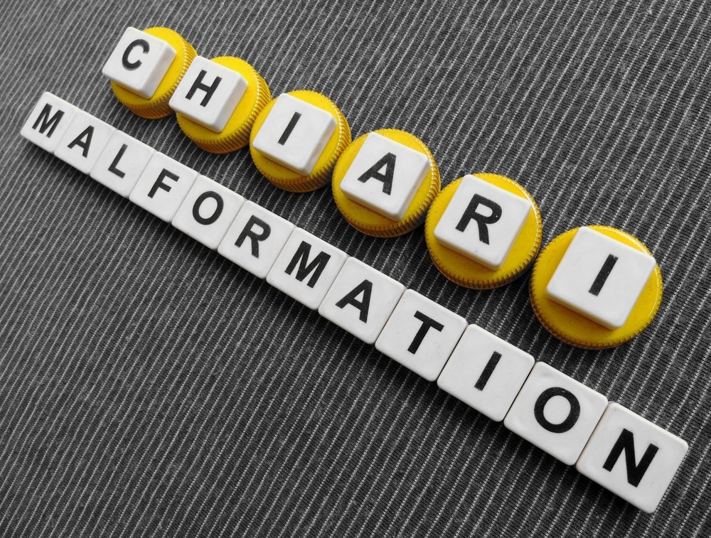 Chiari malformations