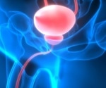What is Bladder Exstrophy-Epispadias-Cloacal Exstrophy Complex?