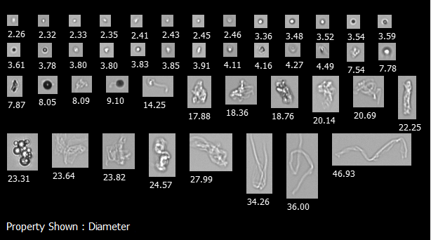 A FlowCam collage of particles present in a biotherapeutic sample, including protein and silicone oil droplet aggregates