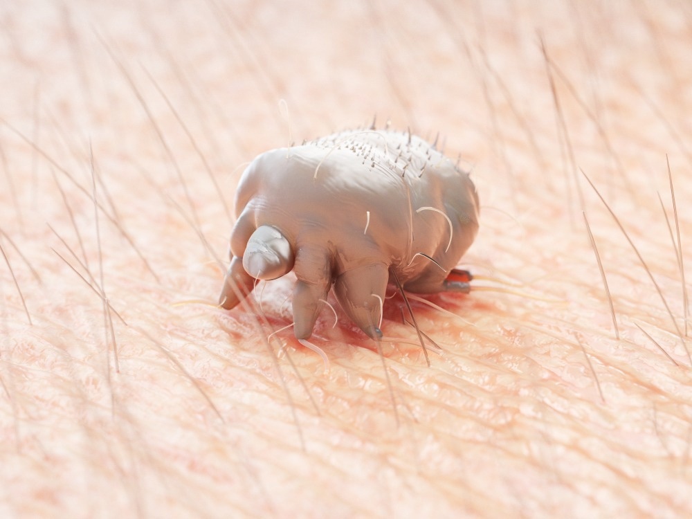 Scabies Mite