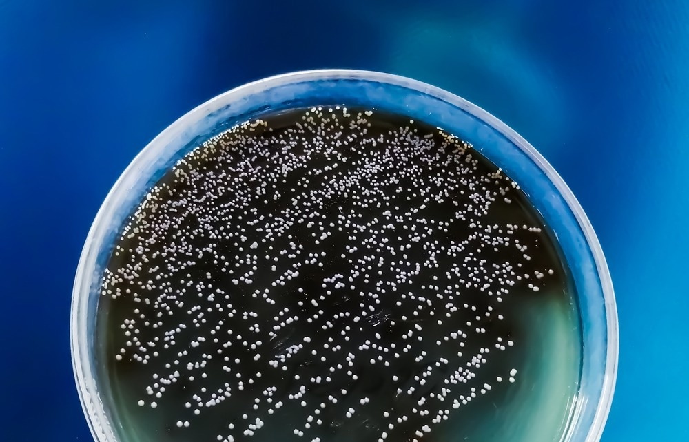 Colonies of Candida albican from urine sample on agar media plate. Image Credit: Saiful52/Shutterstock,com