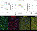 Modeling EMT and FMT in lung fibrosis using high-content imaging for drug discovery