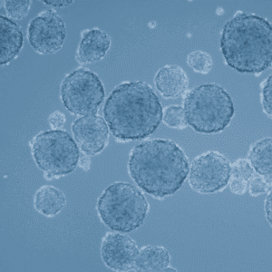 Understanding challenges in cancer therapy utilizing mesenchymal stem cells (MSCs)