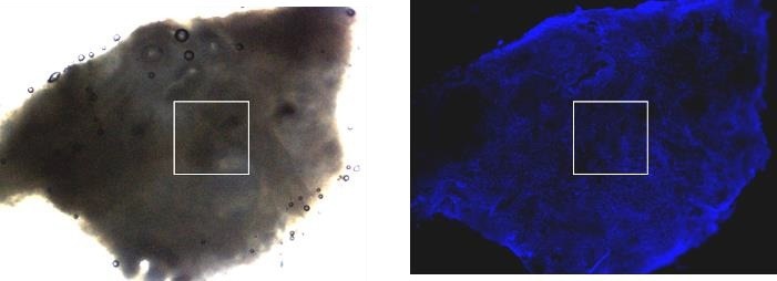 The role of molecular interactions in cell differentiation and cancer invasion