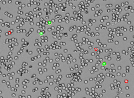 PBMCs counted with AO/PI. Brightfield / Green / Red image overlay for PBMCs counted with AO/PI accurately determine the viability of samples with debris.