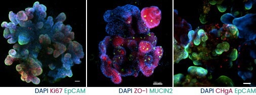 Advancing organoid culture: Innovative solutions for precision tissue engineering
