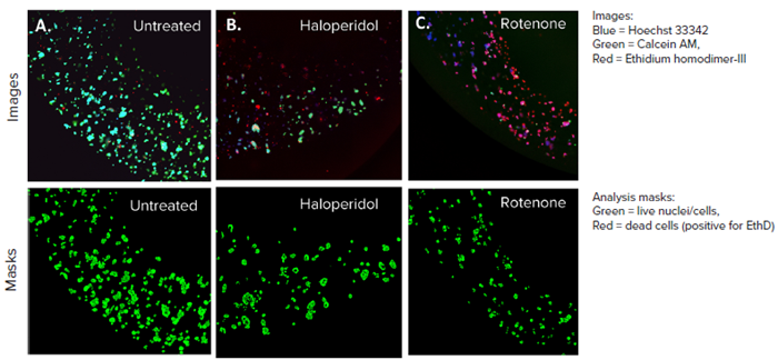 HepG2 3D cell model confocal images, 4X single site image (top panel), and their representative live analysis masks generated by MetaXpress software (bottom panel) A) Untreated control, B) Haloperidol (20 μM), C) Rotenone (4 μM). The control wells had more HepG2 cells and lower cell death whereas, the treated cells had more red-stained cells and a lower number of live cells, indicating cell death.