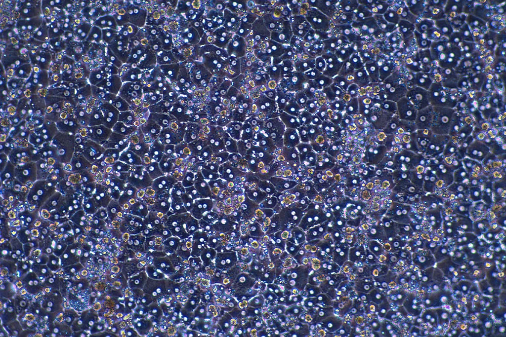 How to choose the right hepatocytes for different study types