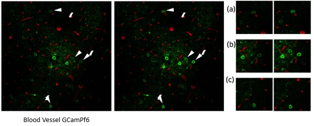 Visualization of GCaMP Expression