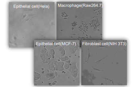 Time-lapse image of EGFP expression following pCMV GFP plasmid transfection (Scale bar, 200 μm). The images were collected every 2 hr for 40 hr