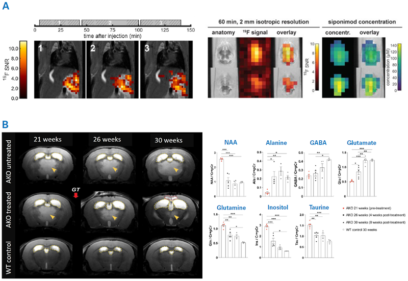 Examples for using MRI for examining theranostic and gene therapy. A) Theranostic MRI of the multiple sclerosis drug Siponimod. Left: 2D 19F UTE images overlaid on anatomical 1H images. Each image corresponds to the average of 3 × 10 min 19F acquisition acquired at different time intervals after oral administration of Siponimod (gray boxes). Middle and right: 3D UTE 19F MRI in ex vivo brain tissue and Siponimod concentration estimates. B) MRI therapy monitoring of adeno-associated virus-mediated gene delivery to a Canavan disease mouse model. Aspartoacylase (ASPA)-deficient lacZ-knock-in (AKO) mice replicate Canavan disease-like pathology. Left: Serial T2-weighted MR imaging revealed hyperintensities in the thalamus in AKO mice (yellow arrowheads) resulting from spongiform vacuolization. Yellow dashed lines outline the lateral and third ventricles. Adeno-associated virus-mediated gene therapy in AKO mice (AKO treated) at 22 weeks of age resulted in reduced vacuolization. Right: Serial MRS was used to assess changes in brain metabolites in response to the gene therapy. Gene therapy reduced NAA levels in AKO mice and normalized metabolite levels at 30 weeks of age