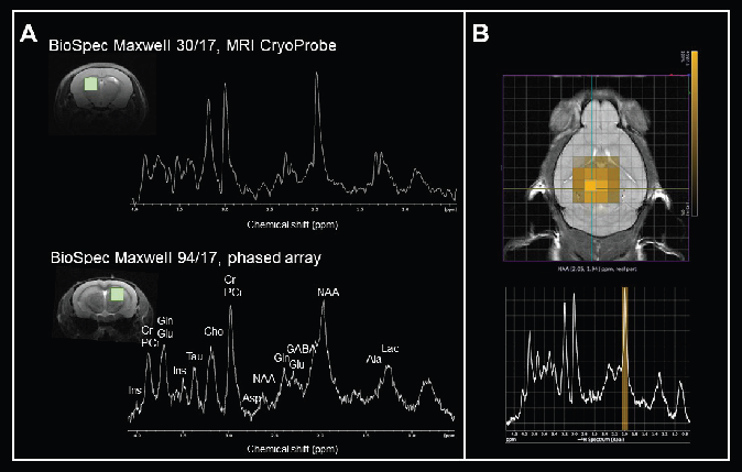 Monitoring levels of neurotransmitters and metabolites. A) Axial FLASH images of the mouse brain with volume of interest and in vivo 1H MRS spectra measured from the corresponding brain regions at 3 Tesla and at 9.4 Tesla. Localization sequence: PRESS, volumes 2 x 2 x 2 mm3. The following metabolites were assigned: alanine (Ala), aspartate (Asp), choline (Cho), creatine (Cr), γ-aminobutyric acid (GABA), glutamate (Glu), glutamine (Gln), myo-inositol (Ins), lactate (Lac), N-Acetylaspartate (NAA), phosphocreatine (PCr), and taurine (Tau). Data was acquired with a BioSpec Maxwell 30/17 equipped with a transceive cryogenic quadrature radiofrequency surface probe (MRI CryoProbe) and a BioSpec Maxwell 94/17 using a linearly polarized bird-cage resonator for transmission and a phased-array receive-only surface coil in cross-coil mode. Spectra were processed with TopSpin using the same parameters: line broadening 2, Fourier transform and phase correction. B) Chemical shift imaging of the mouse brain. The morphological T2-weighted TurboRARE image shows the position of the CSI grid with a voxel size of 1.25 x 1.25 x 2 mm3. The corresponding 1H MRS-spectra from the selected voxel are displayed beneath. Data was acquired with a BioSpec Maxwell 94/17 using a linearly polarized bird-cage resonator for transmission and a phased-array receive-only surface coil in cross-coil mode