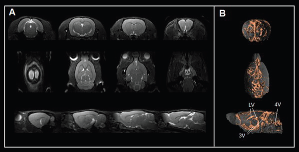 Assessing brain ventricles. A) Axial, coronal, and sagittal T2-weighted TrueFISP images and B) corresponding renderings reveal the cerebrospinal fluid spaces in the rat brain. Rat brain data was acquired with a BioSpec Maxwell 94/17 using a volume coil for transmission and a phased-array coil for reception. Tissues were segmented and rendered using PMOD. LV = lateral ventricle; 3V = third ventricle; 4V = forth ventricle