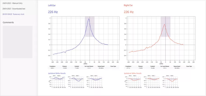 A step-by-step guide to obtaining accurate tympanogram results