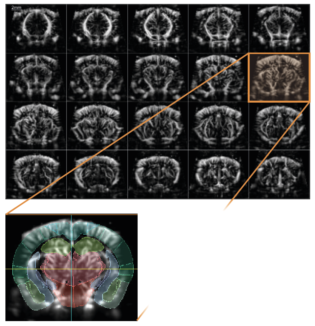 Montage visualization of the mouse brain vasculature with 100 μm in-plane resolution, and showing automatic registration of a transcranial 3D scan to the Allen Mouse Brain Reference Atlas.