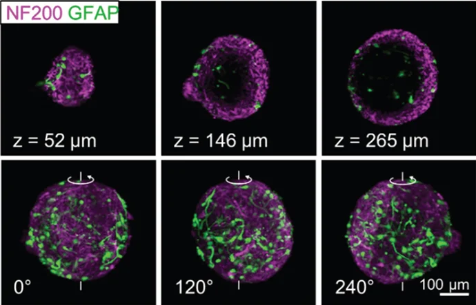 Co-cultured organoids with neuronal cells (magenta) and astrocytes (green). The top row shows slices, and the bottom row shows 3D reconstructions and stills of rotations of organoids. Figure 4 - altered from red-green to magenta-green to be colorblind-friendly. Adapted and reproduced under Creative Commons Attribution 4.0 International License (shared with author permission)