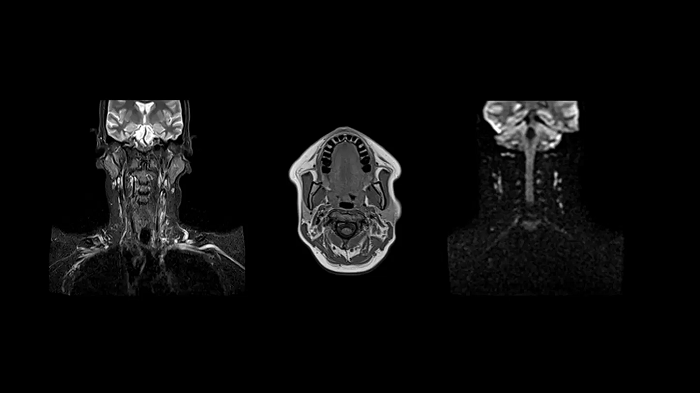 80 cm bore MAGNETOM Free.Max