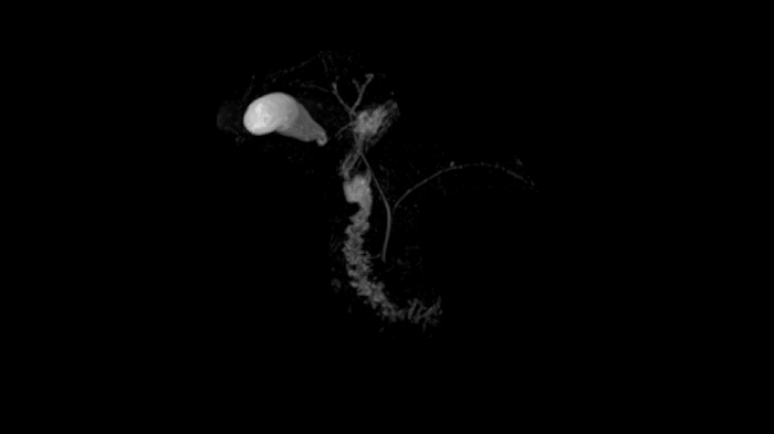 80 cm bore MAGNETOM Free.Max