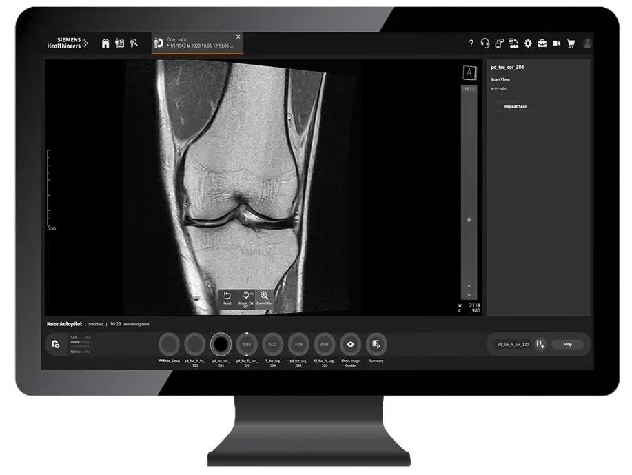 MAGNETOM Altea features and benefits