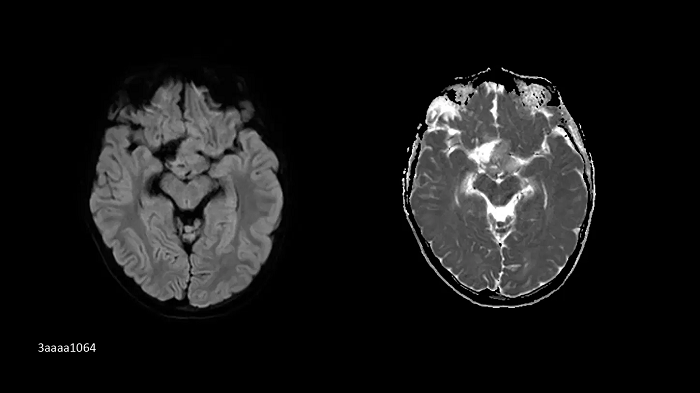 3T MRI scanner MAGNETOM Vida