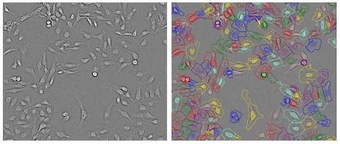 CellVoyager CQ3000: Fast, high-resolution 3D imaging for cell culture