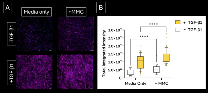 Increased sensitivity. Addition of the macromolecular crowding (MMC) agent to the lung fibroblast culture medium increases the deposition of extracellular collagen I protein. (A) extracellular collagen I deposition. Images were acquired using the ImageXpress Confocal HT.ai imaging system (B) quantified expression levels of extracellular collagen I deposition