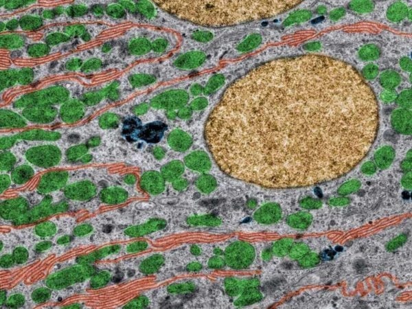 Colored Transmission electron microscopy (TEM) of kidney tubule cells