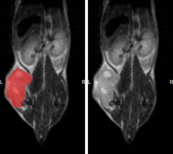 Hindlimb tumor growth: Monitoring the growth of xenograft tumor grown in the mouse hindlimb is identified with T2-weighted images. Segmentation of tumor region of interests (in red) on each tumor-containing slice allows accurate volume quantification.