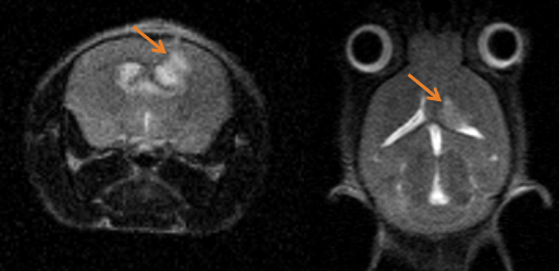 Monitoring tumor growth in the mouse brain, following the orthotopic injection of glioblastoma cells, using T2-weighted images.