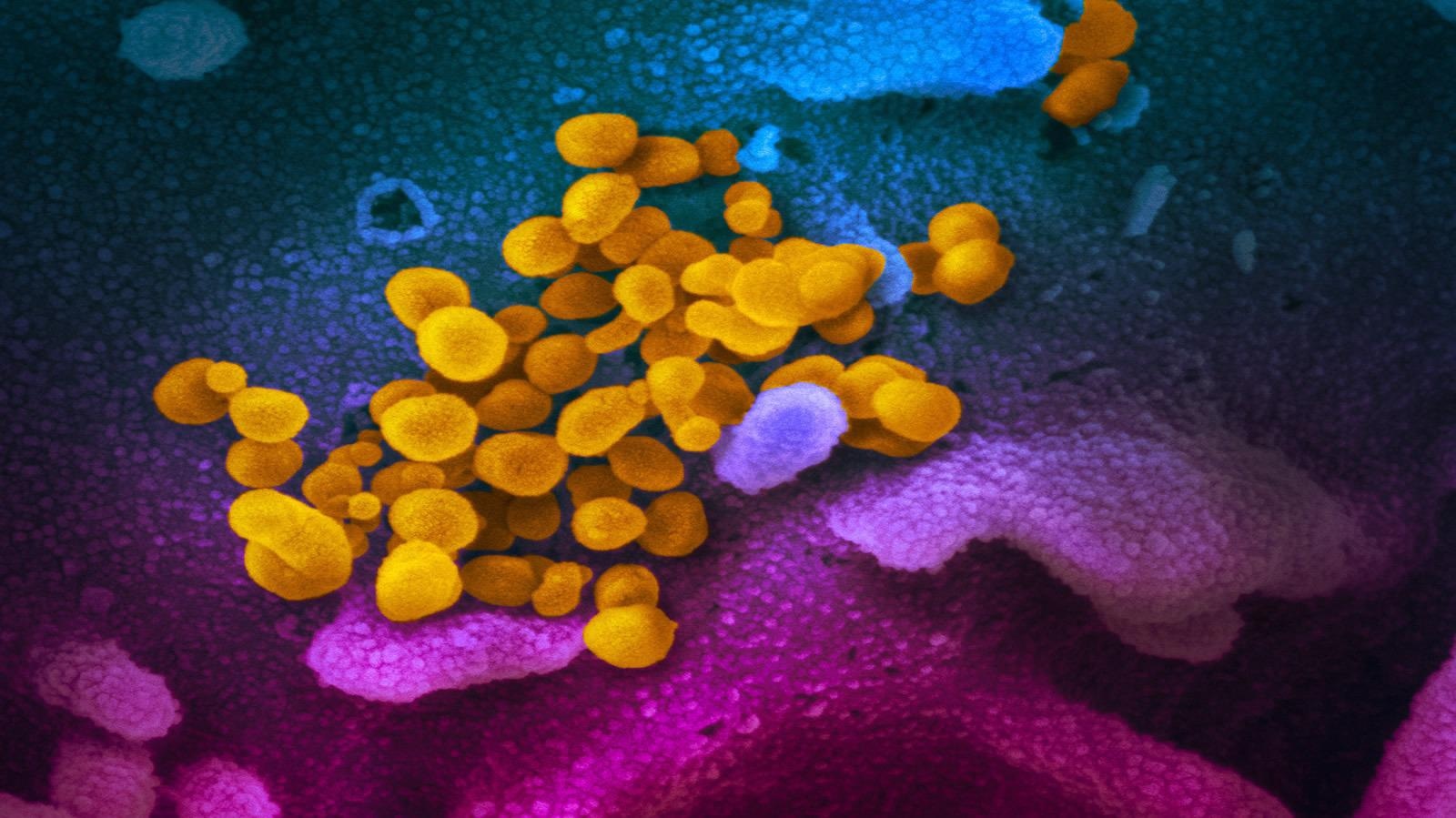 Study: COVID-19 reinfection: the role of natural immunity, vaccines, and variants. Image Credit: NIAID