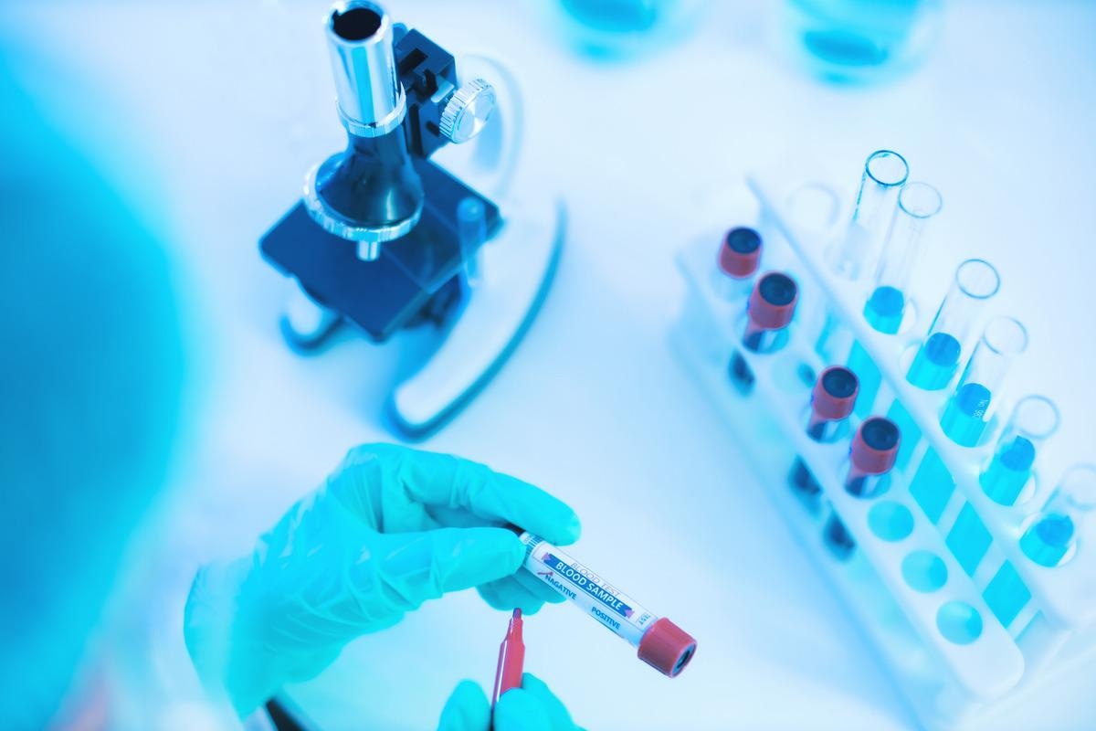 Study: Protein Posttranslational Signatures Identified in COVID-19 Patient Plasma. Image Credit: anon_tae/Shutterstock