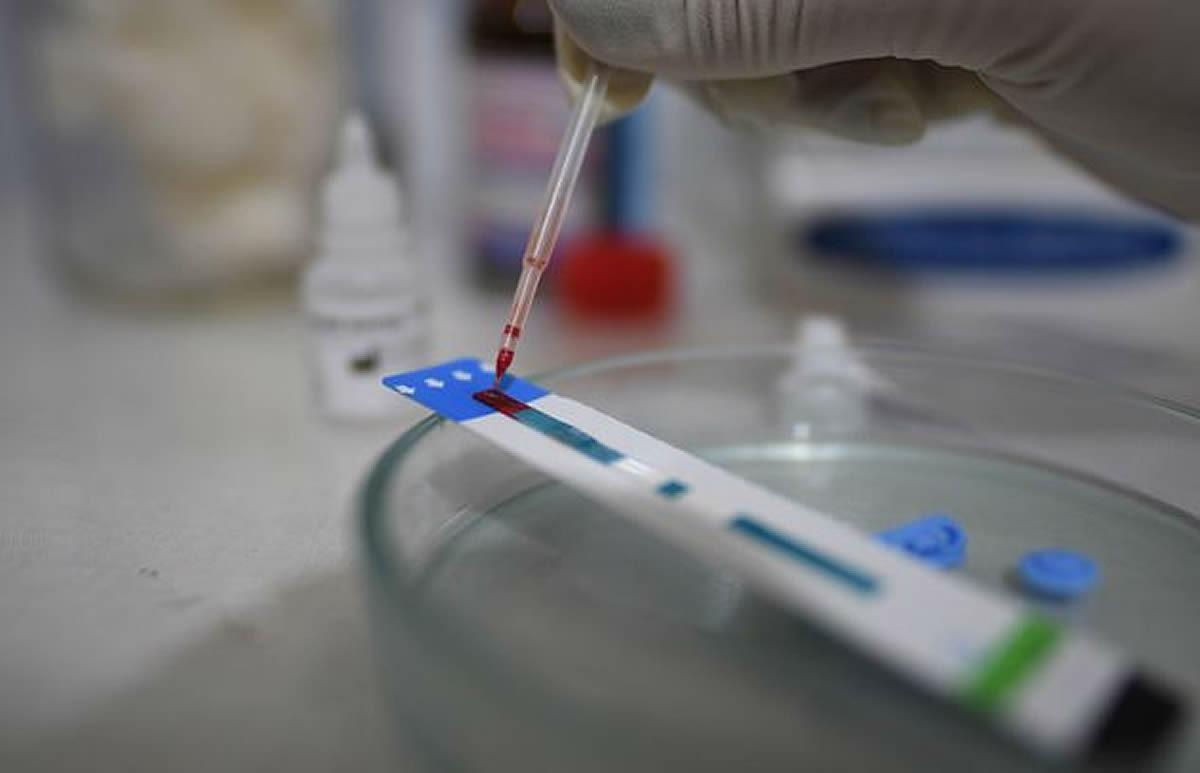 HIV testing. Tajikistan, 2021. Credit: UNAIDS