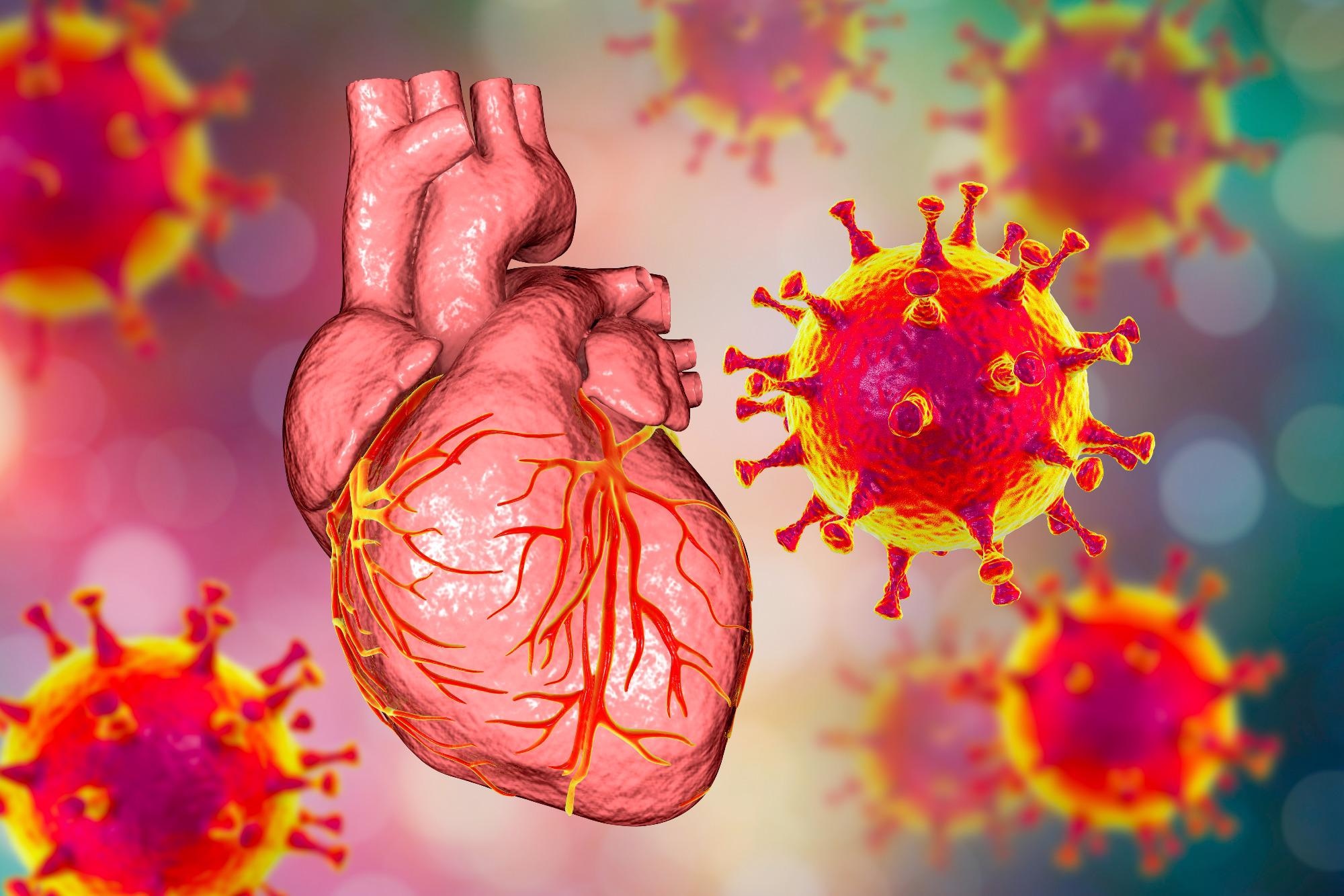 Study: Frequency of COVID-19 in patients with myocardial infarction treated with primary percutaneous coronary intervention. Image Credit: Kateryna Kon / Shutterstock