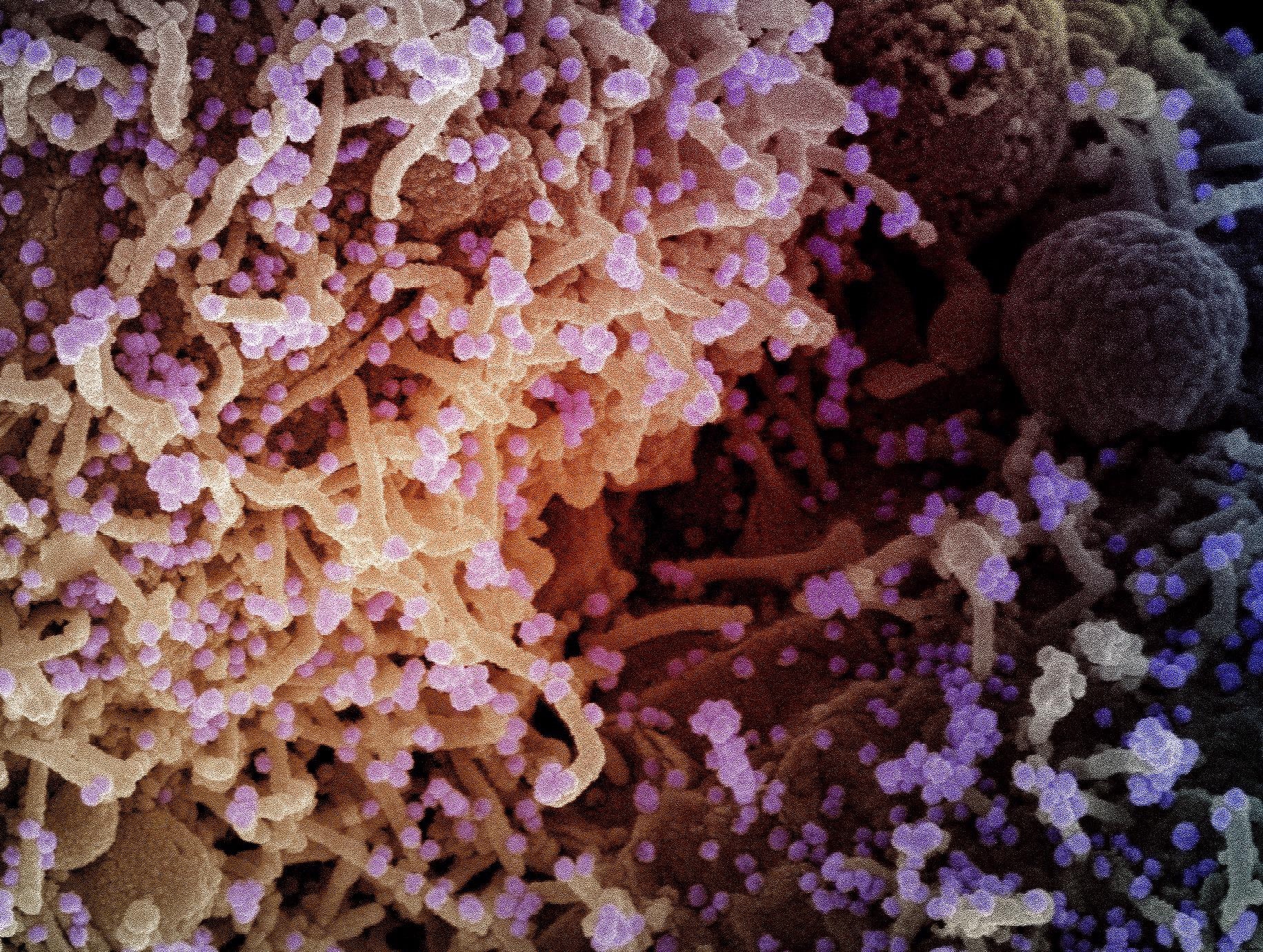 Study: A mRNA vaccine encoding for a RBD 60-mer nanoparticle elicits neutralizing antibodies and protective immunity against the SARS-CoV-2 delta variant in transgenic K18-hACE2 mice. Image Credit: NIAID