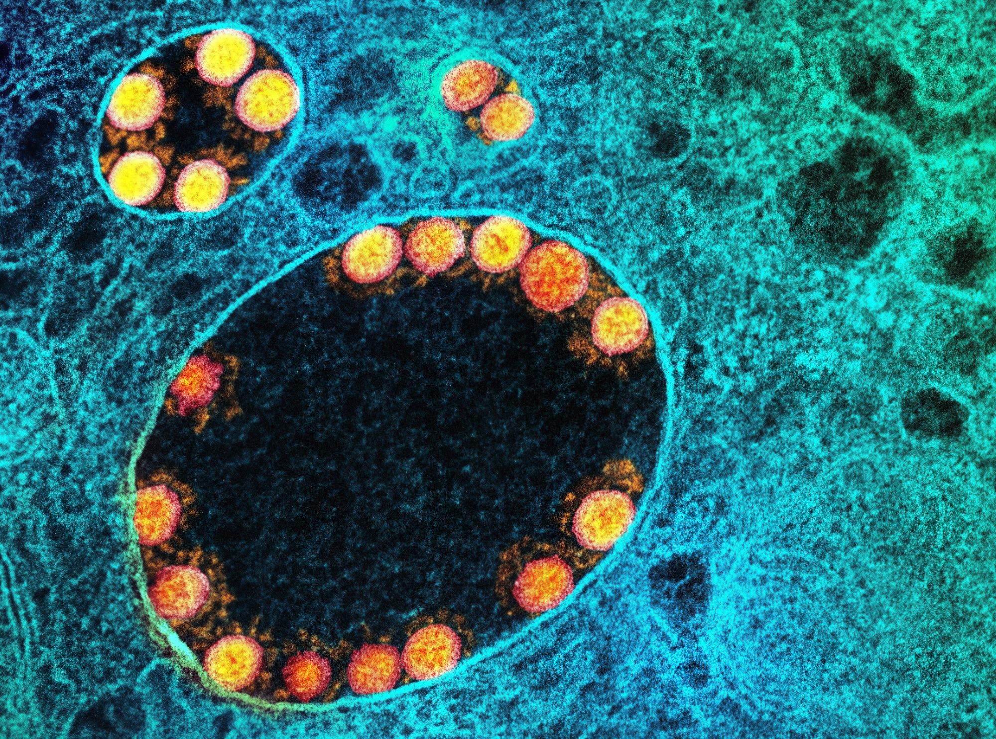 Study: SARS-CoV-2 Omicron neutralization and risk of infection among elderly after a booster dose of Pfizer vaccine. Image Credit: NIAID