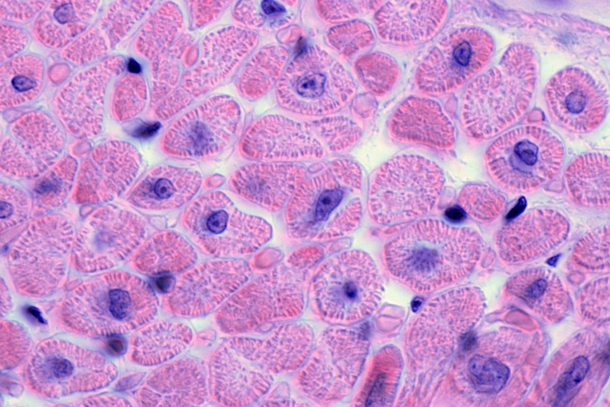 Study: Transcriptomic profiling of cardiac tissues from SARS-CoV-2 patients identifies DNA damage. Image Credit: Jose Luis Calvo/Shutterstock