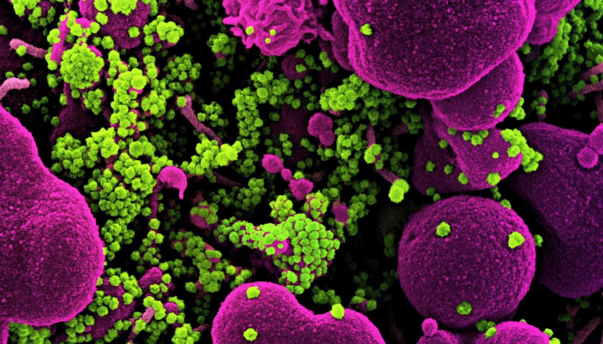 Study: BA.2.12.1, BA.4 and BA.5 escape antibodies elicited by Omicron infection. Image Credit: NIAID