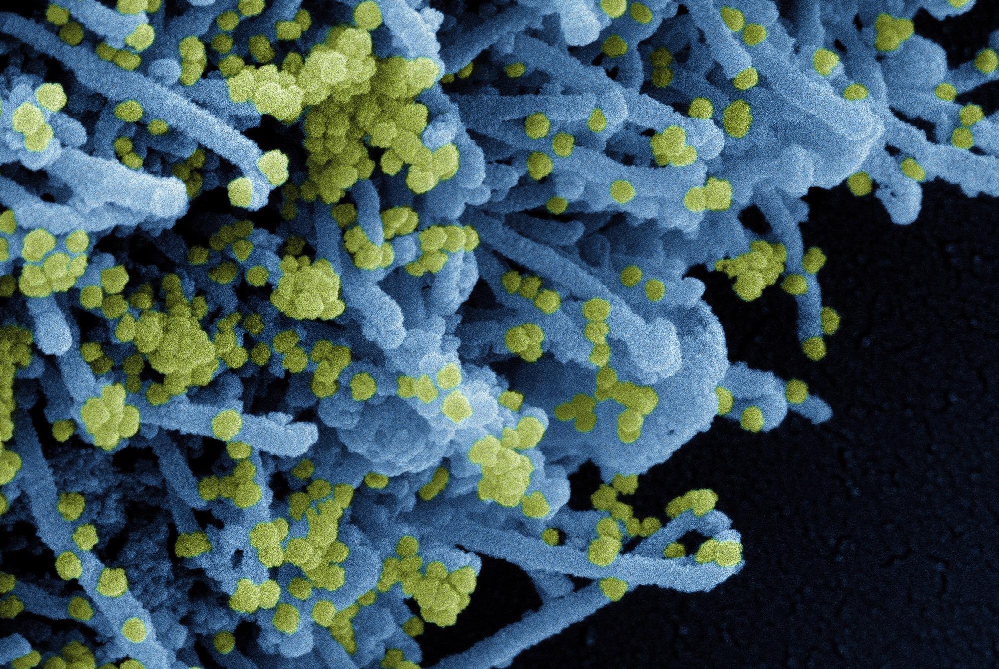 Study: The highly conserved stem-loop II motif is important for the lifecycle of astroviruses but dispensable for SARS-CoV-2. Image Credit: NIAID