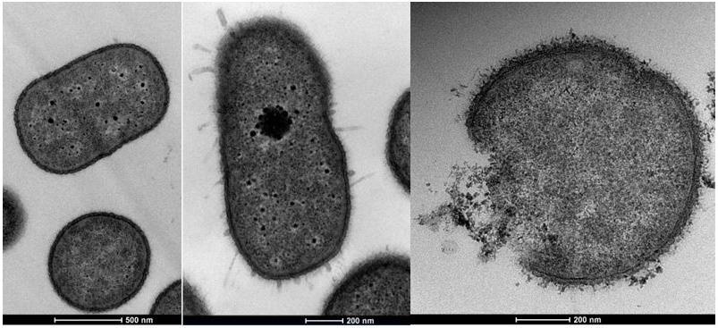 Researchers focus on how bacterial cells adapt and resist antibiotics