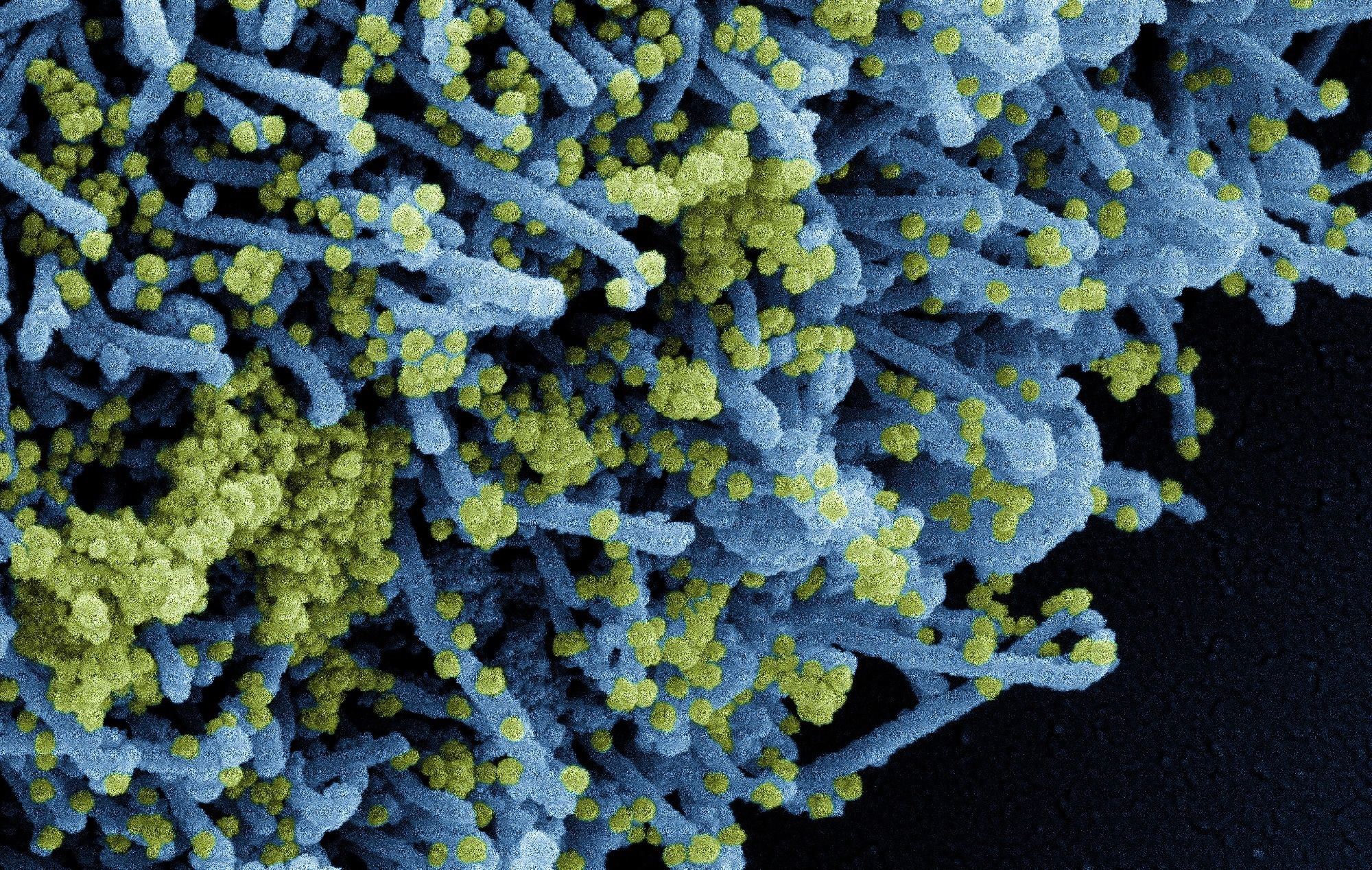 Study: Nucleic acid biomarkers of immune response and cell and tissue damage in children with COVID-19 and MIS-C. Image Credit: NIAID