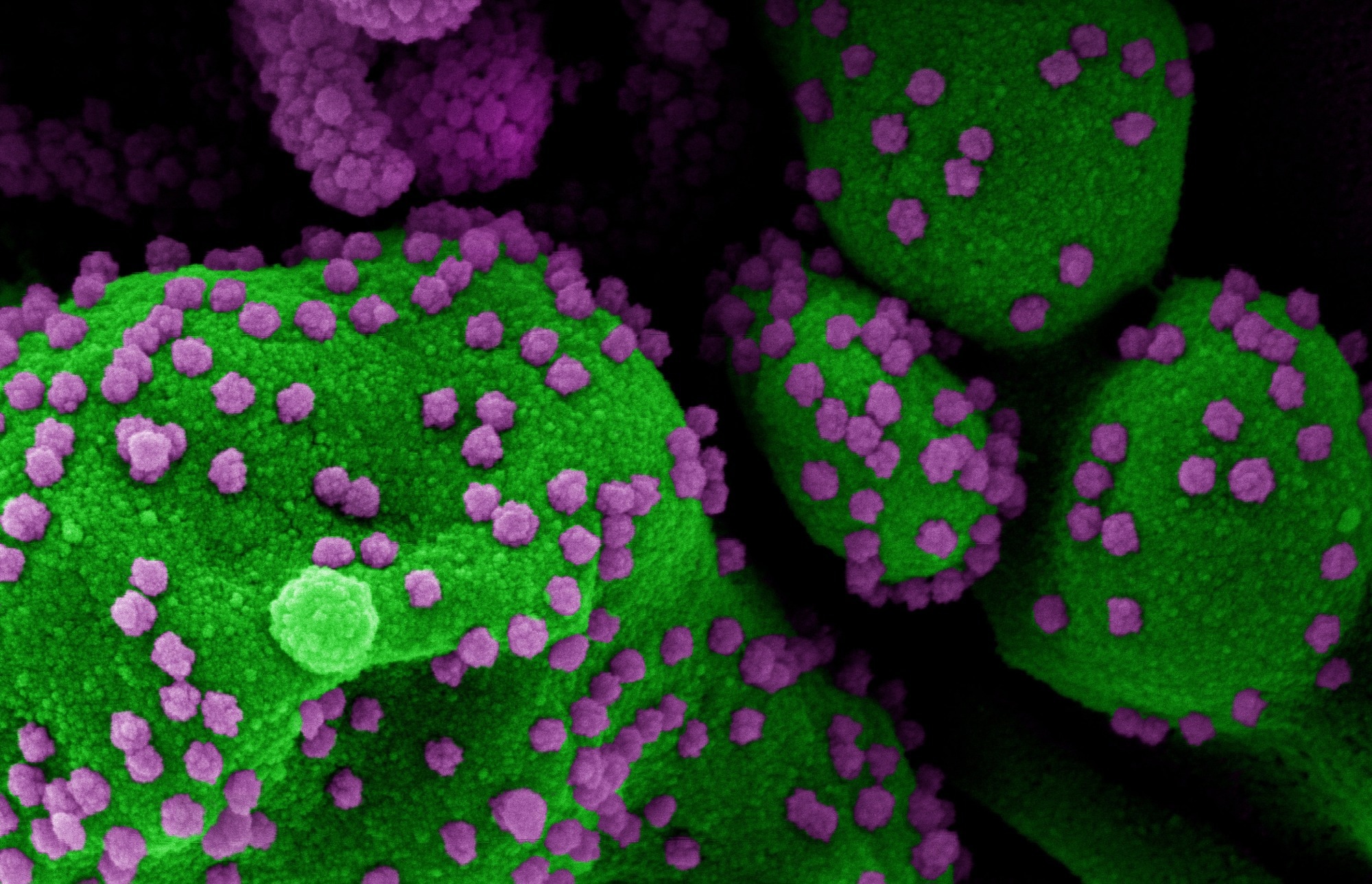 Review Article: The humoral response and antibodies against SARS-CoV-2 infection. Image Credit: NIAID